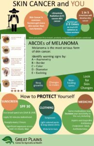 prevention of skin cancer